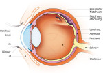 Netzhautablösung (Amotio retinae)